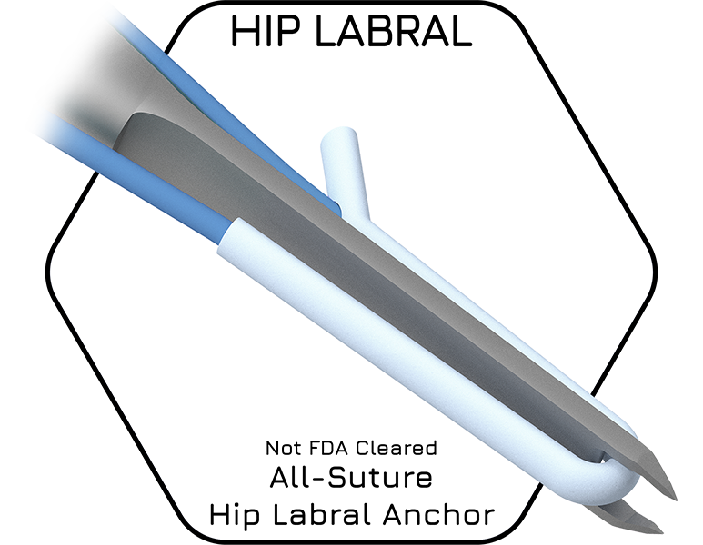 HIP LABRUM